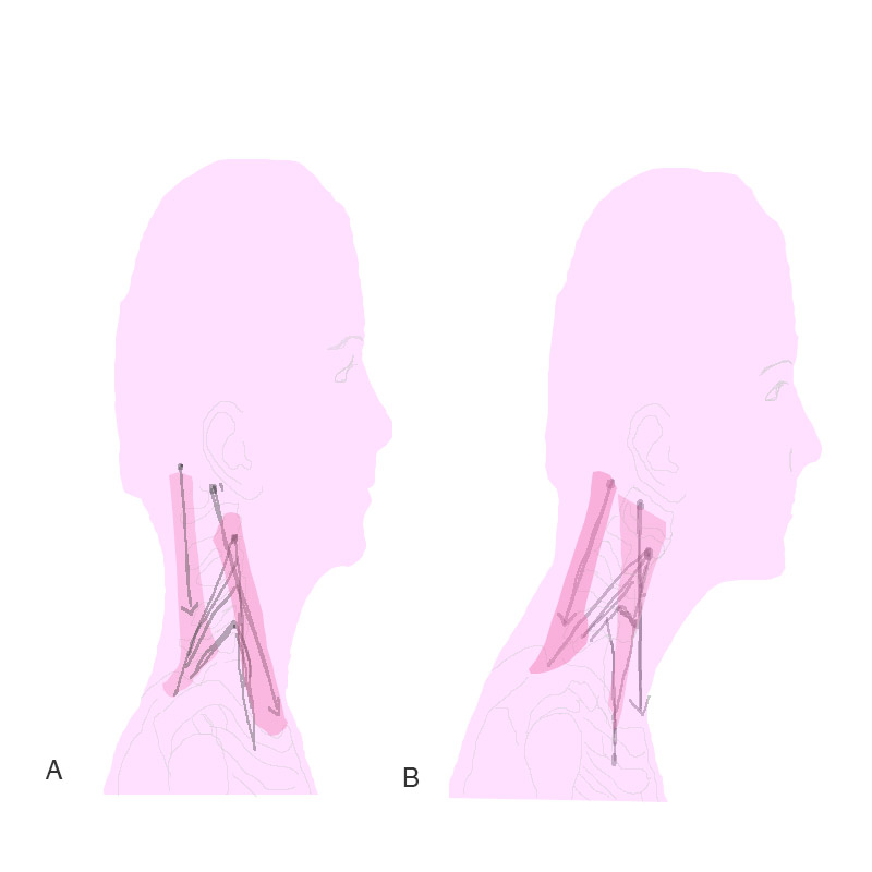 Diagram of correct head posture and poor head posture